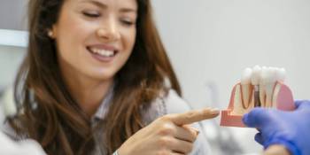 Dental Implants in Farmington