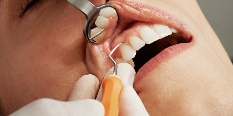 dentist in grants nm