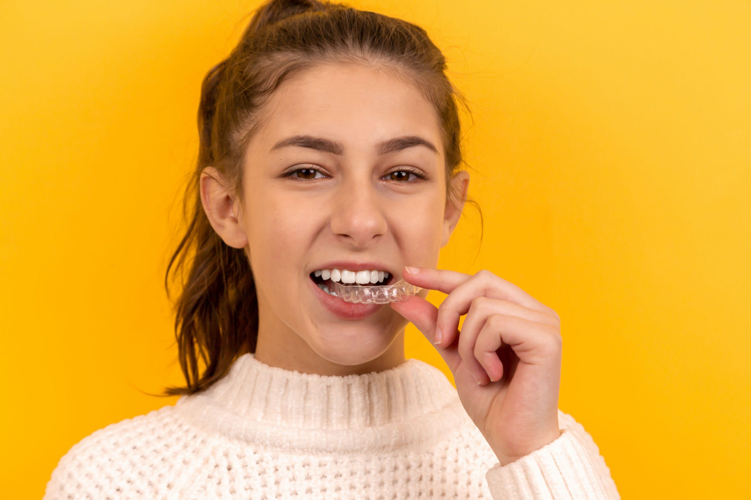 Invisalign Braces