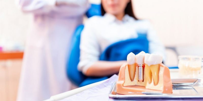 Dental Implants The Ultimate Solution For Your Missing Teeth