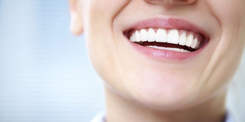 Everything You Need to Know About Professional Teeth Whitening