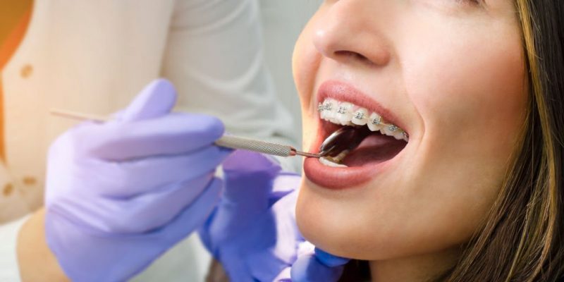 How To Find The Right Orthodontist For Your Needs In Gallup, NM