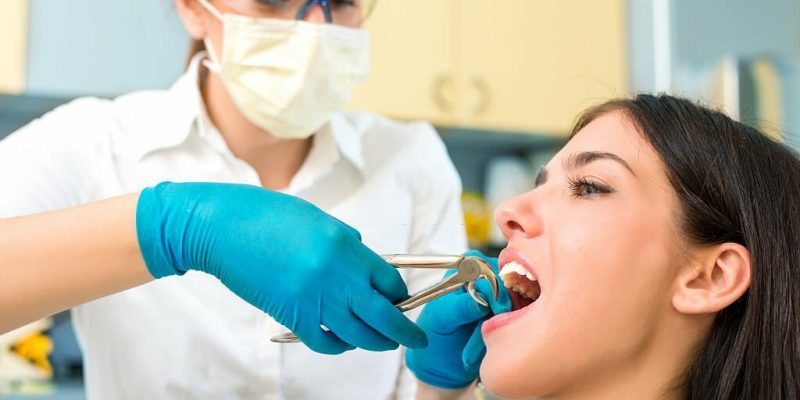 Dental Teeth Pulling: Your Complete Guide From Procedure To Recovery