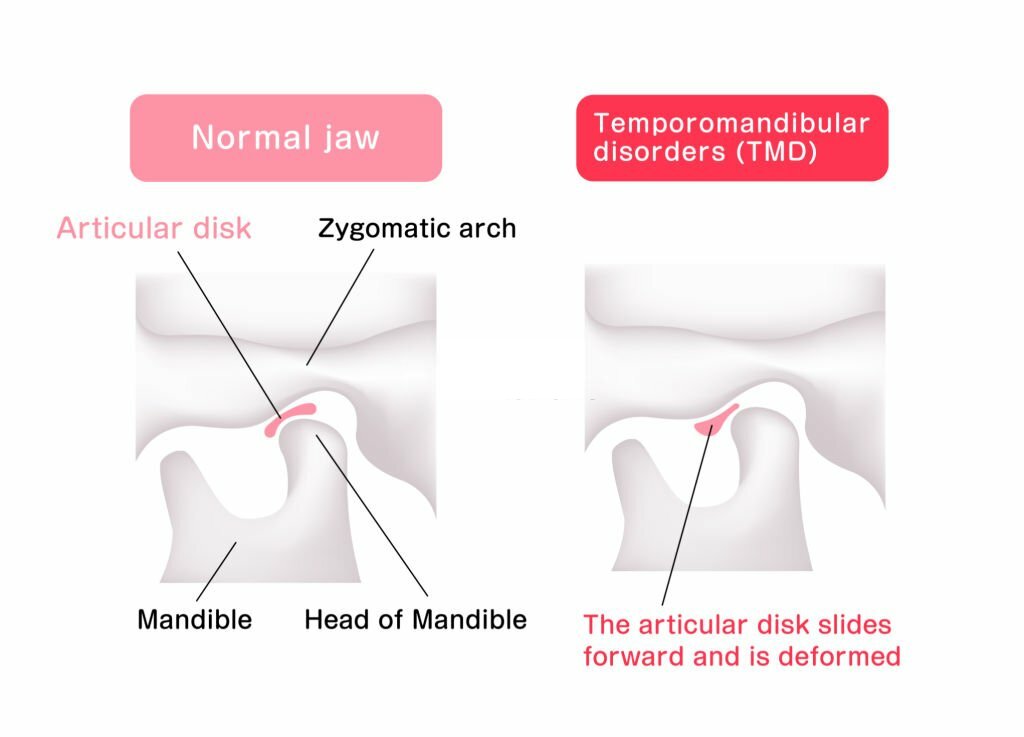 tmj function