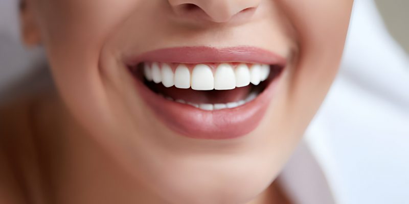 Know The Truth: Is Teeth Whitening Gum Effective?_FI