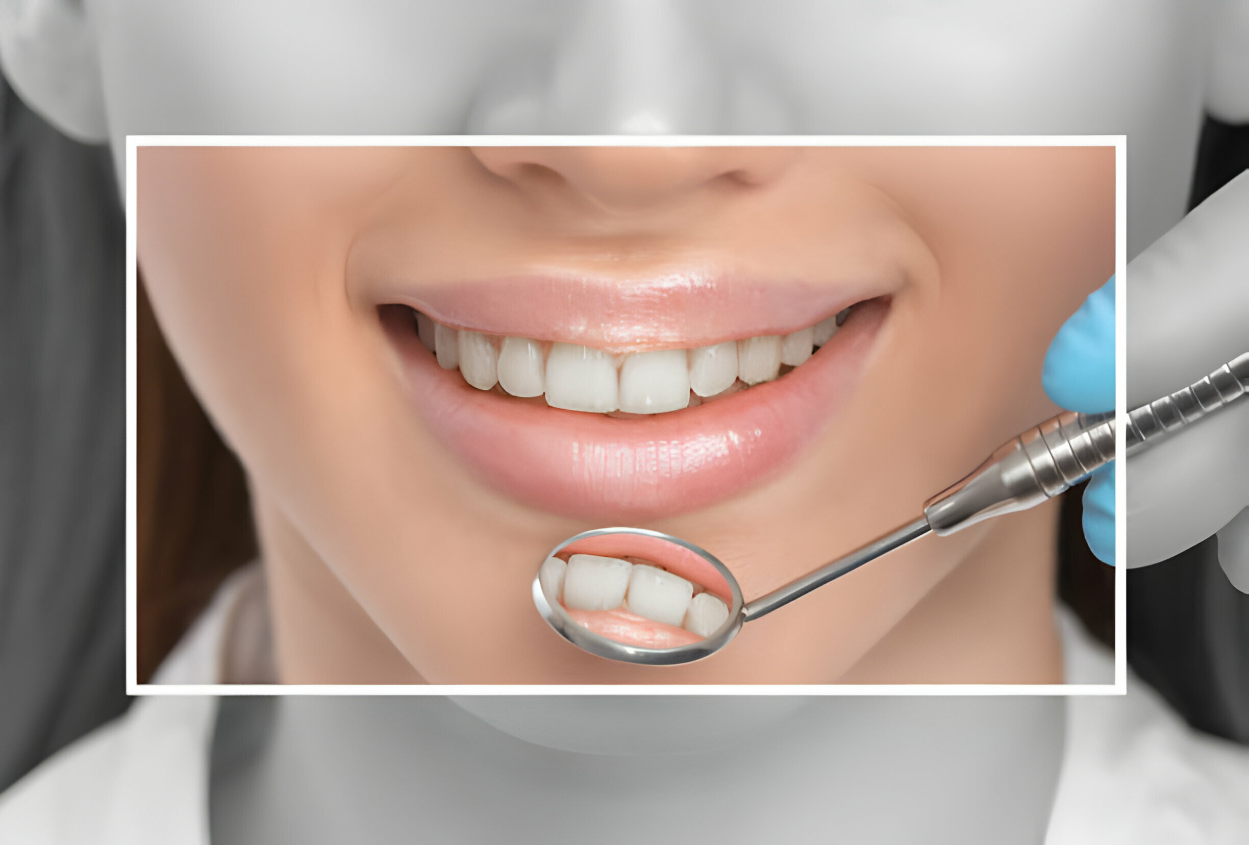 Unlocking the Secrets of Dental Crowns: A Comprehensive Guide_2