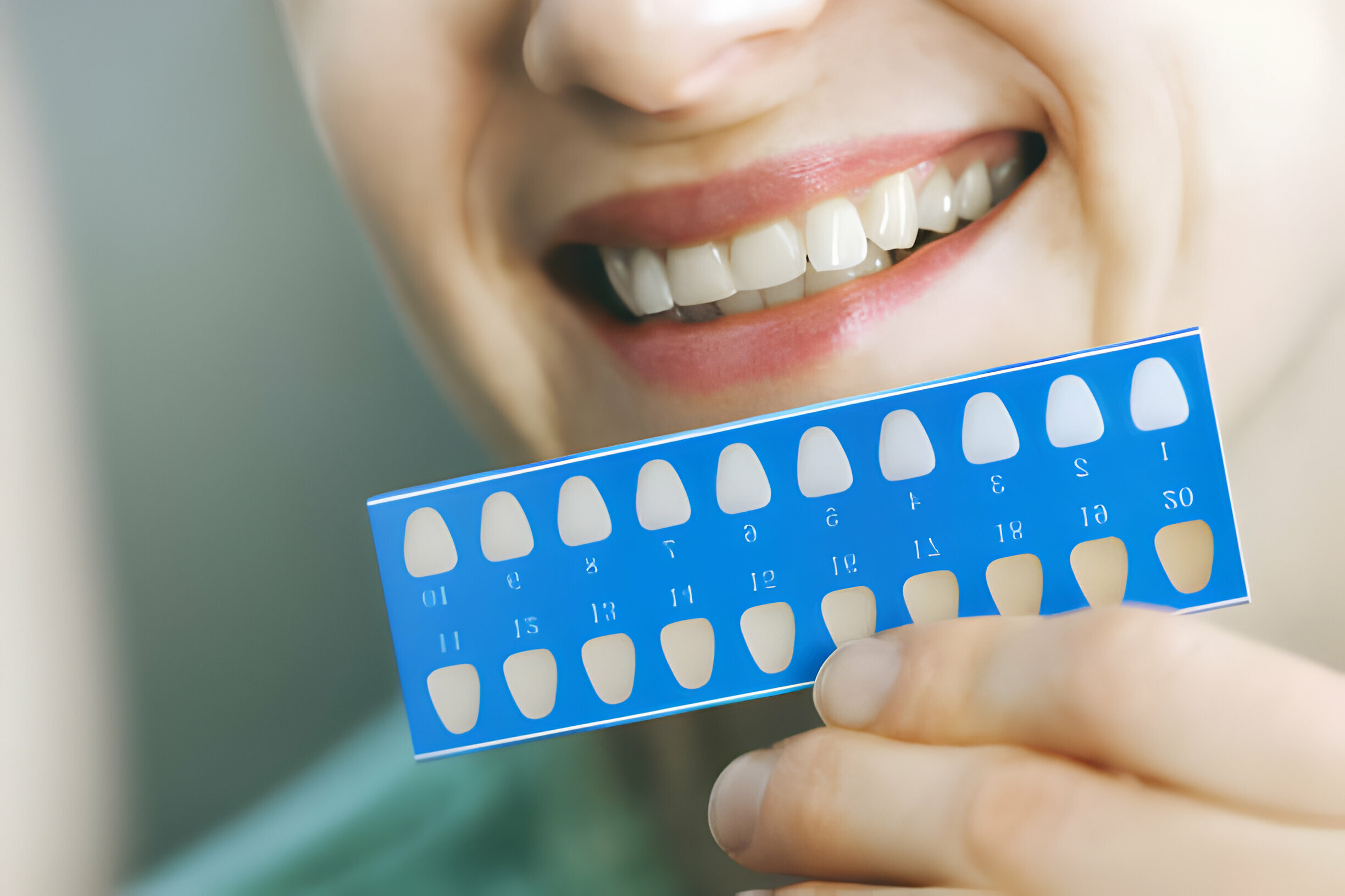 How to Maintain Your Bright Smile After Teeth Whitening_1