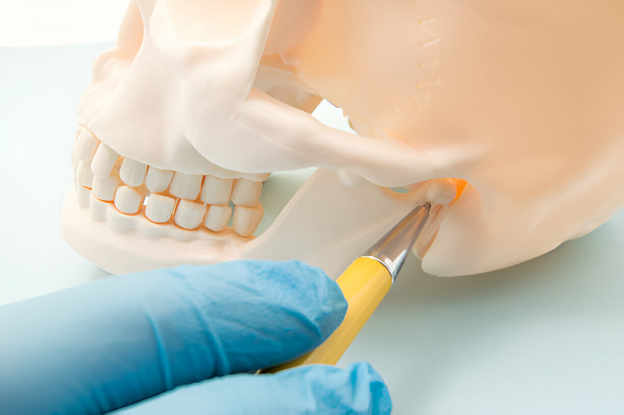 How to Choose the Best TMD/TMJ Treatment for You_FI