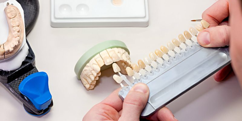 The Importance of Restorative Dentistry for Your Health: Expert Insights from Sundance Dental in Bloomfield_FI