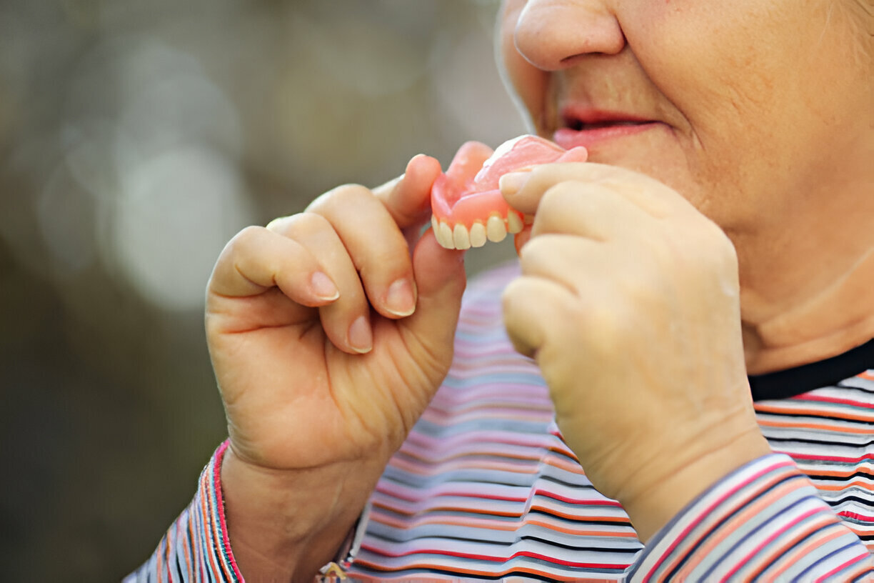Sundance Dental Bloomfield : The Benefits of Getting Dentures from a Trusted Dentist in Bloomfield_1