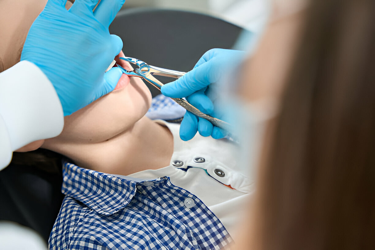 Finding the Best Dentist in Grants for Tooth Extractions – Why Choose Sundance Dental Grants?_1
