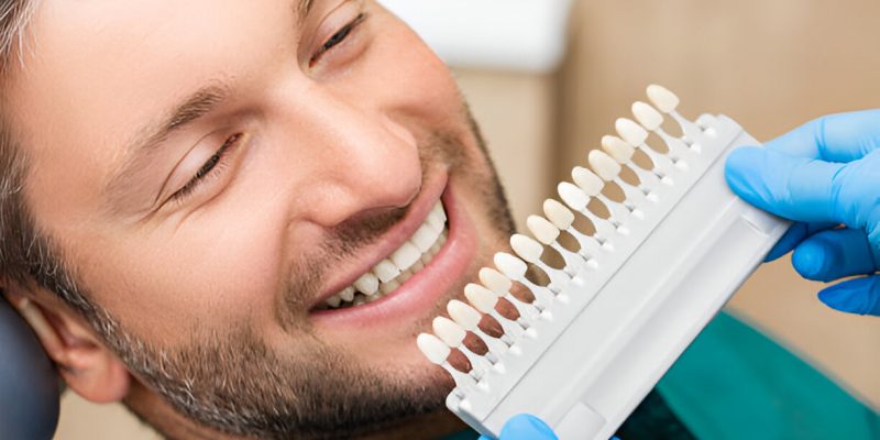 Top Cosmetic Dentistry Trends: Transform Your Smile With Veneers in Grants