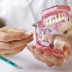 Understanding the Dental Implant Process: What to Expect at Sundance Smiles
