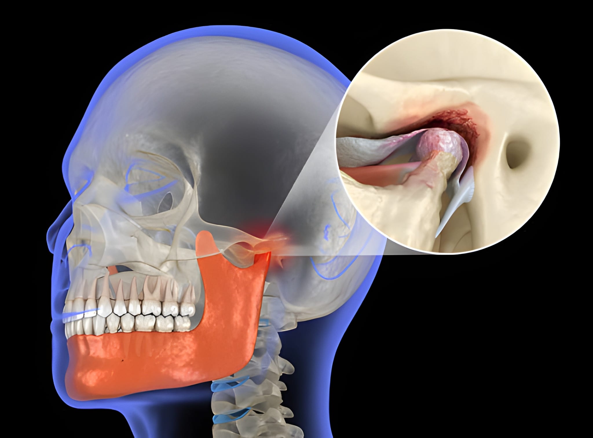 TMJ and Sleep Disruption: Strategies for Better Rest in Grants, NM_FI